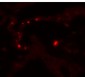 MMP9 Antibody 